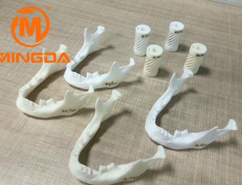 工业级3D打印机在牙科行业的应用(图1) 工业级3D打印机在牙科行业的应用(图1)