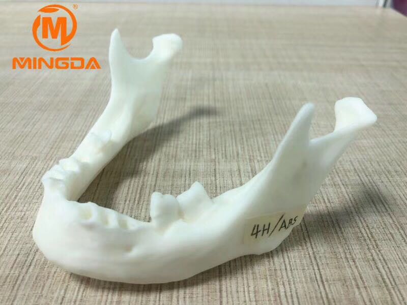 工业级3D打印机在牙科行业的应用(图1)