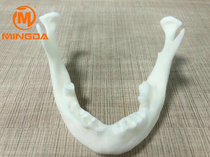 工业级3D打印机在牙科行业的应用(图2) 工业级3D打印机在牙科行业的应用(图2)